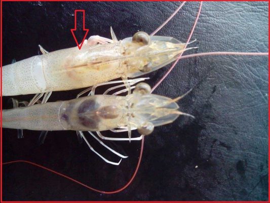 Bệnh hoại tử gan tụy cấp tính