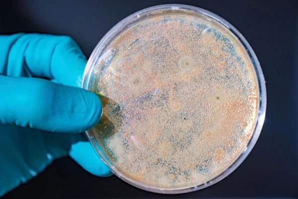 Kiểm tra mật độ vi khuẩn Vibrio trong ao tôm bằng đĩa thạch để quyết định diệt khuẩn ruột diệt khuẩn gan